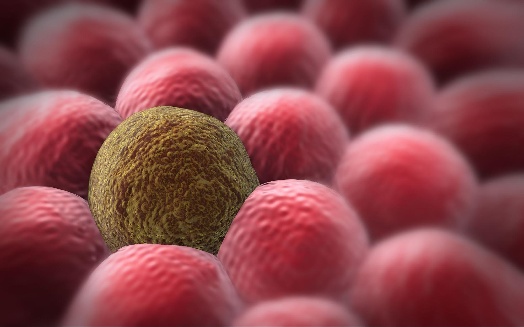 celule_canceroase.jpg