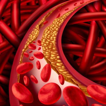 boala-cardiaca-cauze-simptome-prevenire.jpg